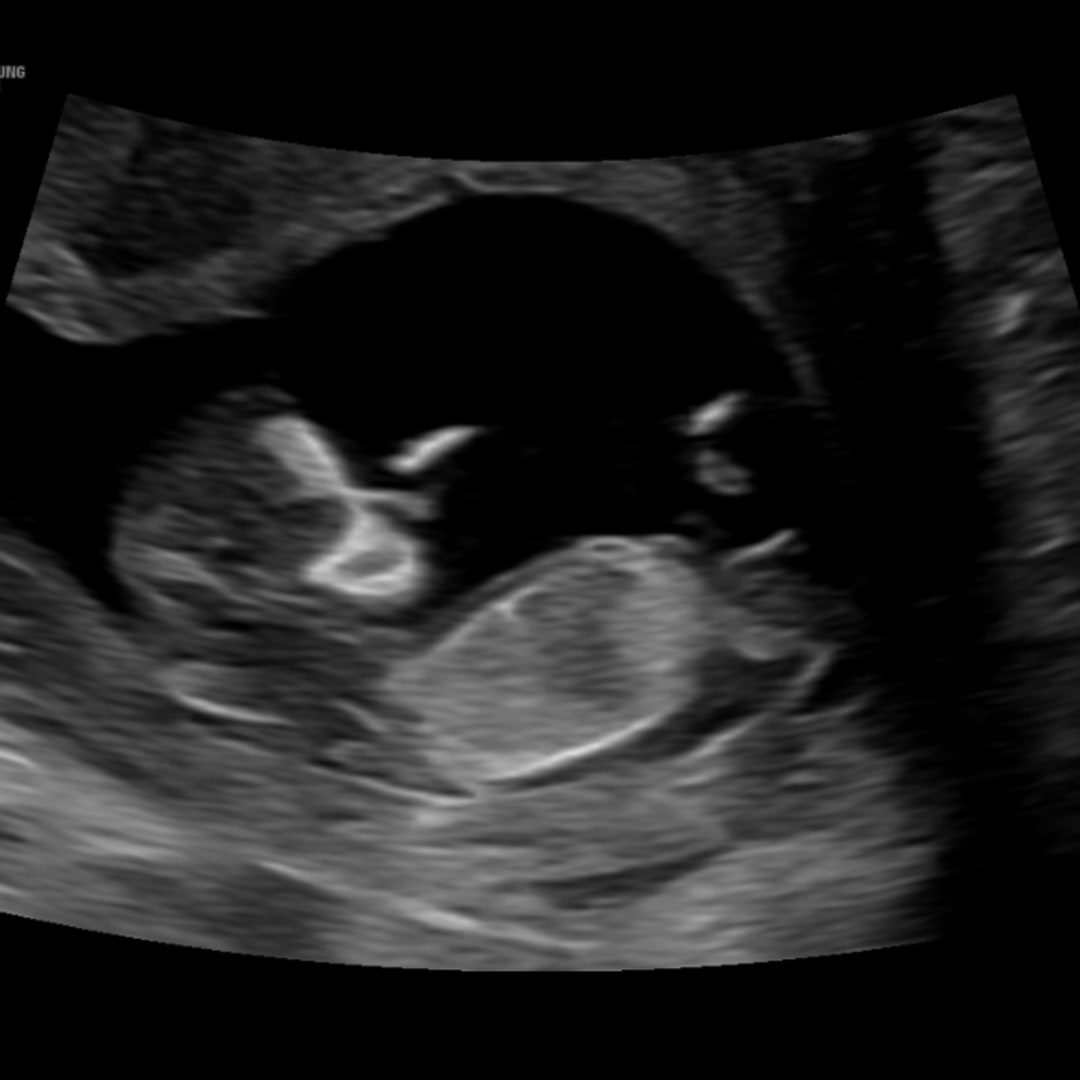 Photo shared by Layne for their Babylist baby registry.