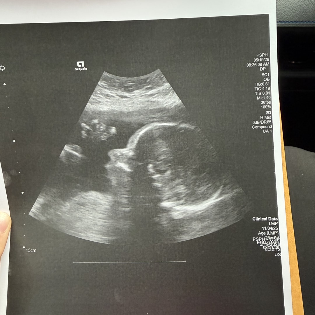Photo shared by Peyton for their Babylist baby registry.