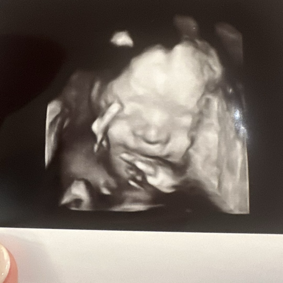 Photo shared by Rachel for their Babylist baby registry.
