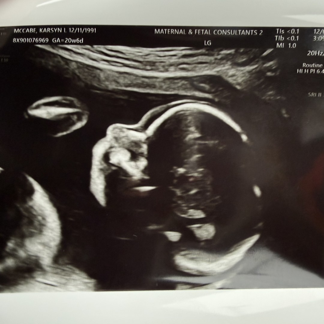 Photo shared by Karsyn for their Babylist baby registry.