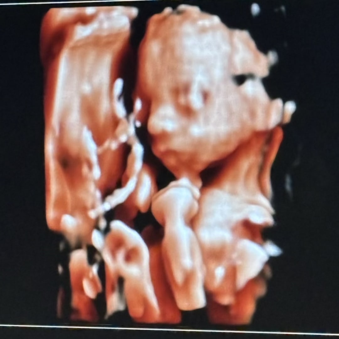 Photo shared by Brittny for their Babylist baby registry.