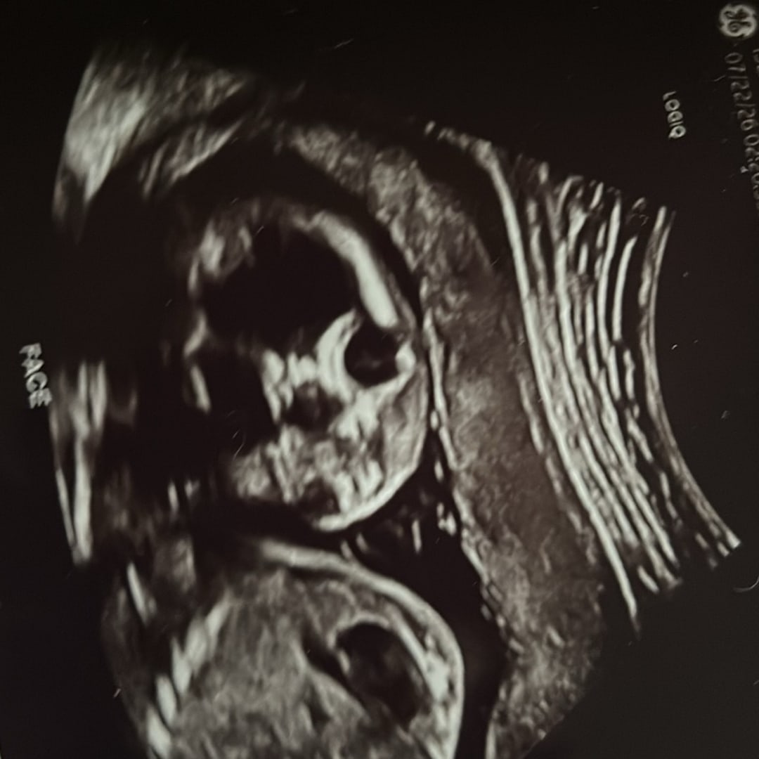 Photo shared by Abby for their Babylist baby registry.