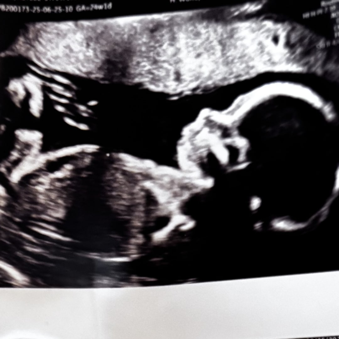 Photo shared by Keylee for their Babylist baby registry.