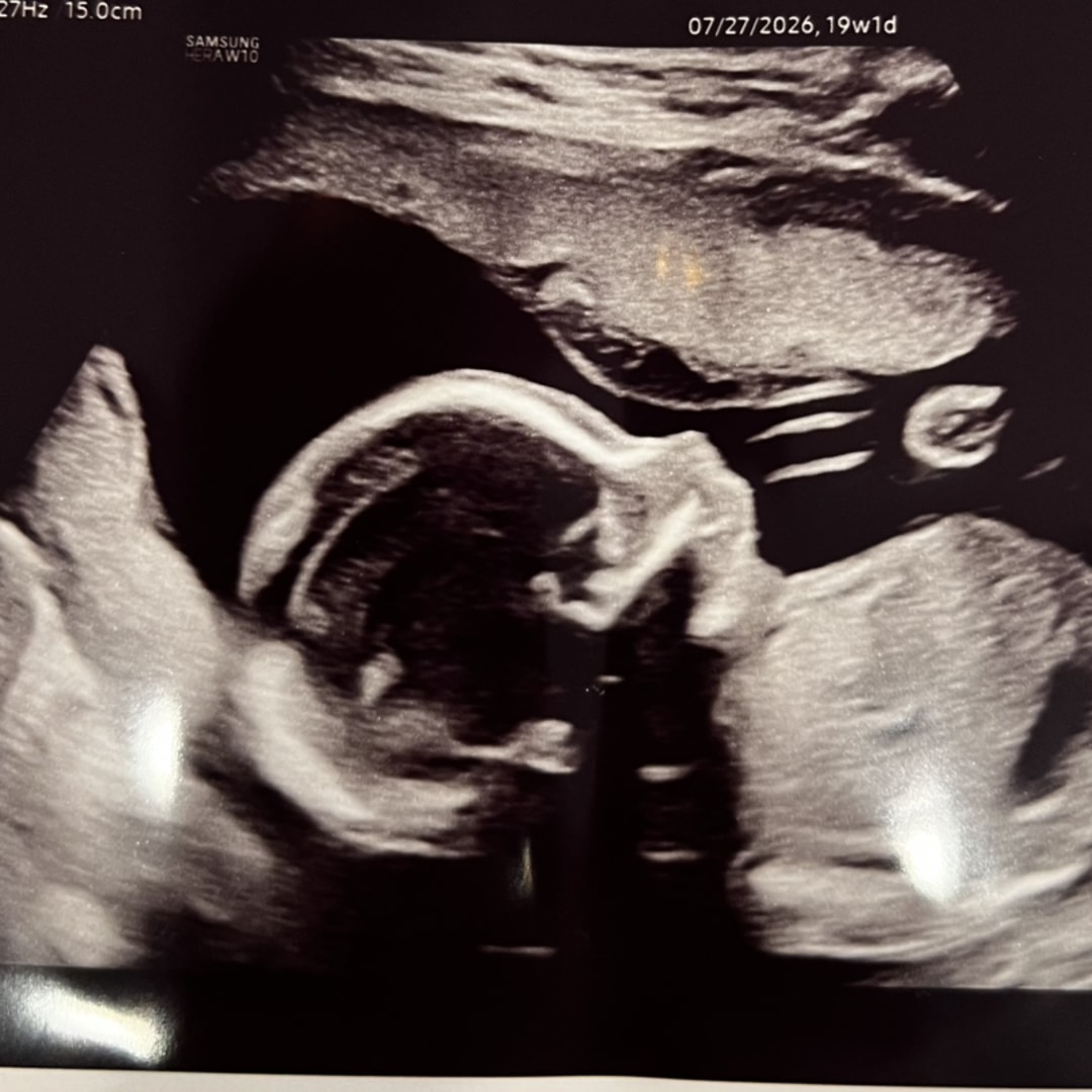 Photo shared by Kathleen for their Babylist baby registry.