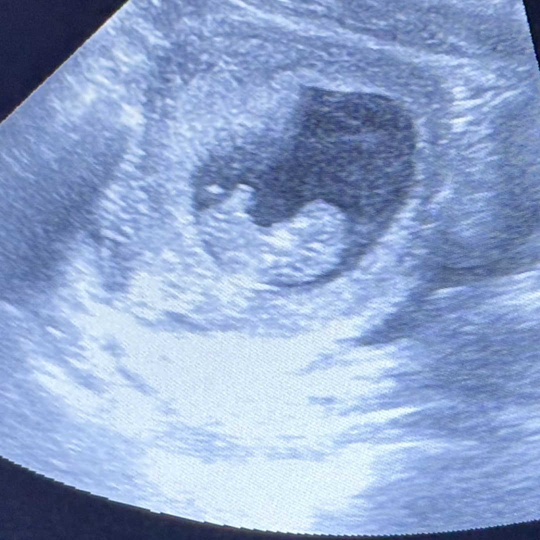 Photo shared by Marquetta for their Babylist baby registry.