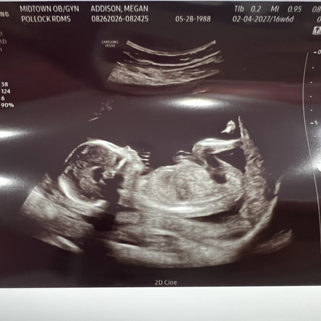 Photo shared by Megan for their Babylist baby registry.