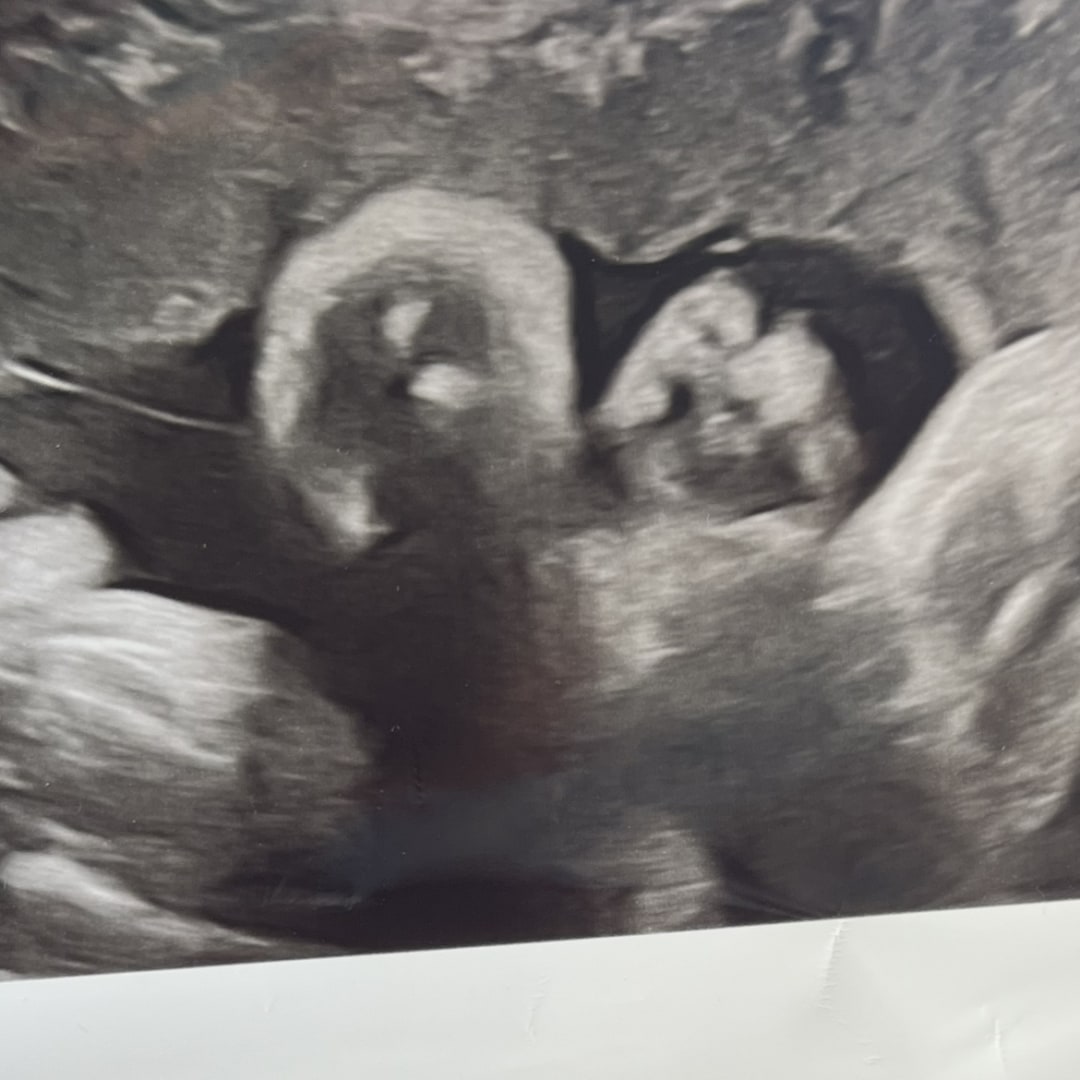 Photo shared by Cassandra for their Babylist baby registry.