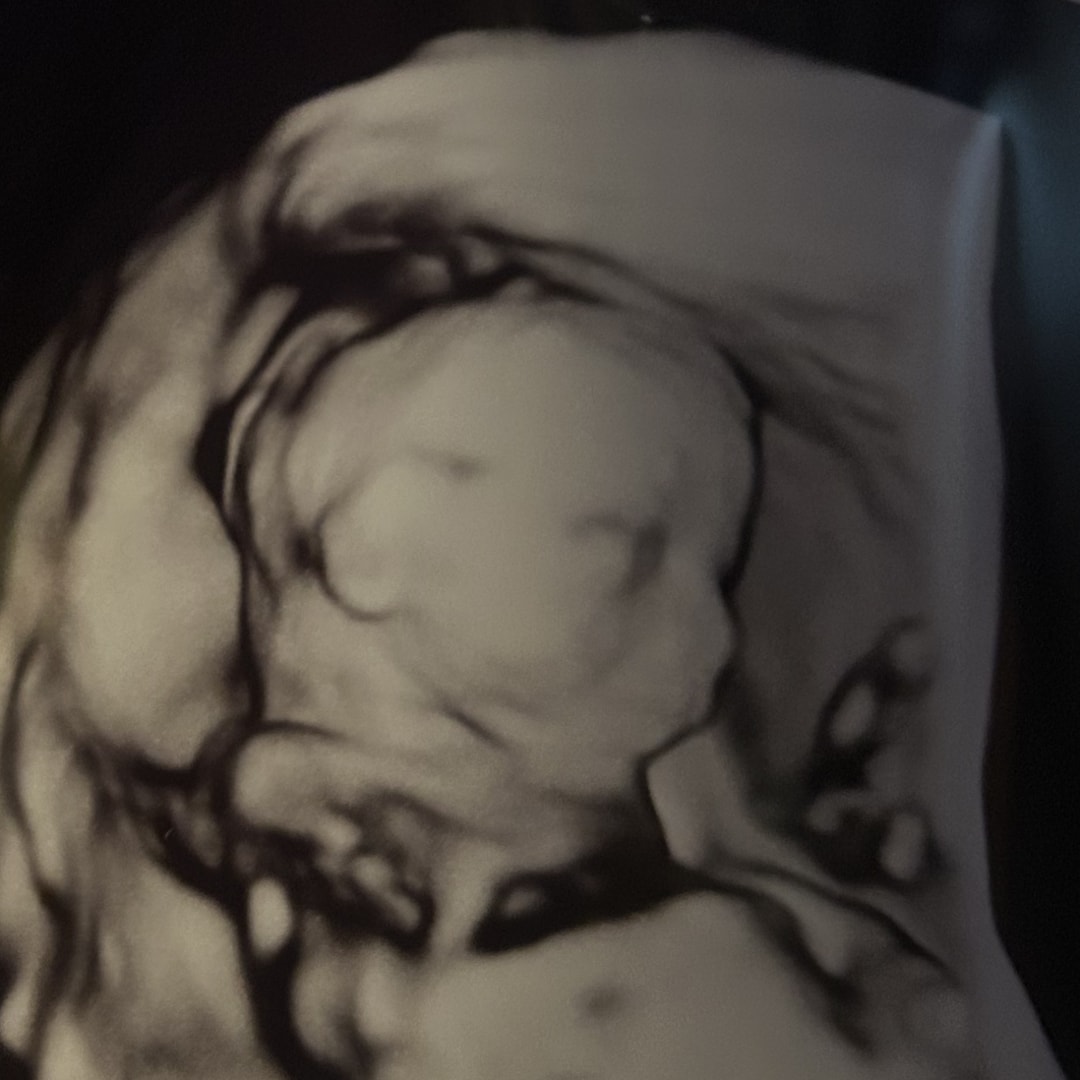 Photo shared by Chloe for their Babylist baby registry.