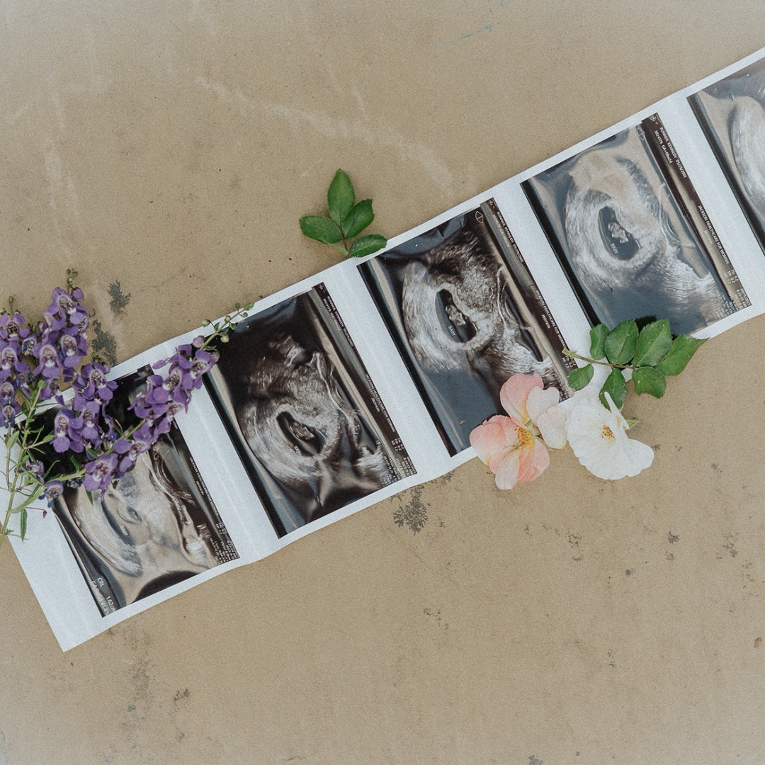 Photo shared by Kennedy & Matt for their Babylist baby registry.