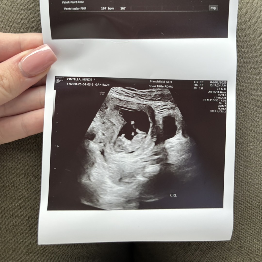 Photo shared by Kenzie for their Babylist baby registry.