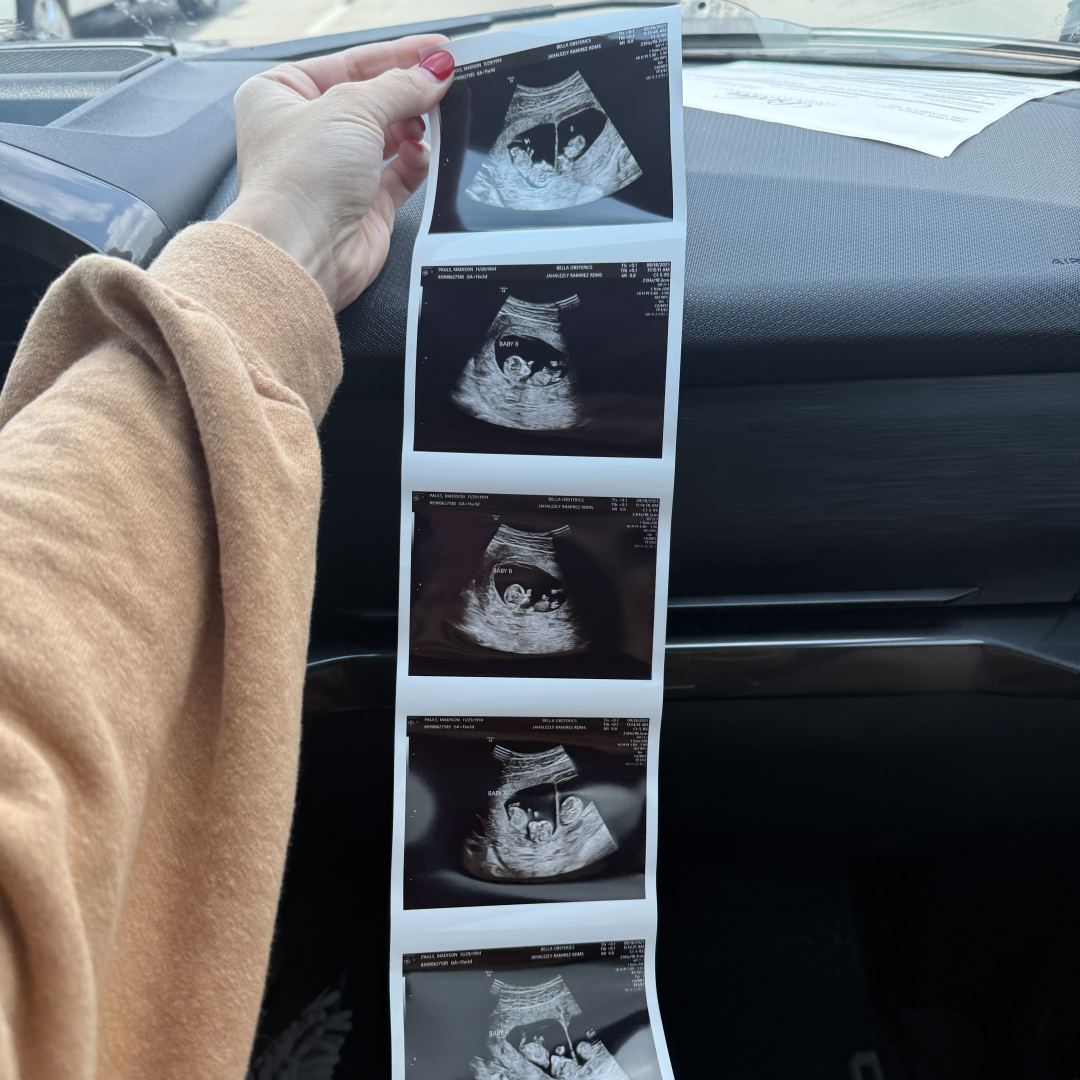 Photo shared by Madison for their Babylist baby registry.