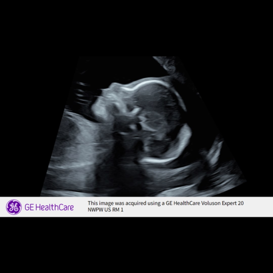 Photo shared by Denise for their Babylist baby registry.