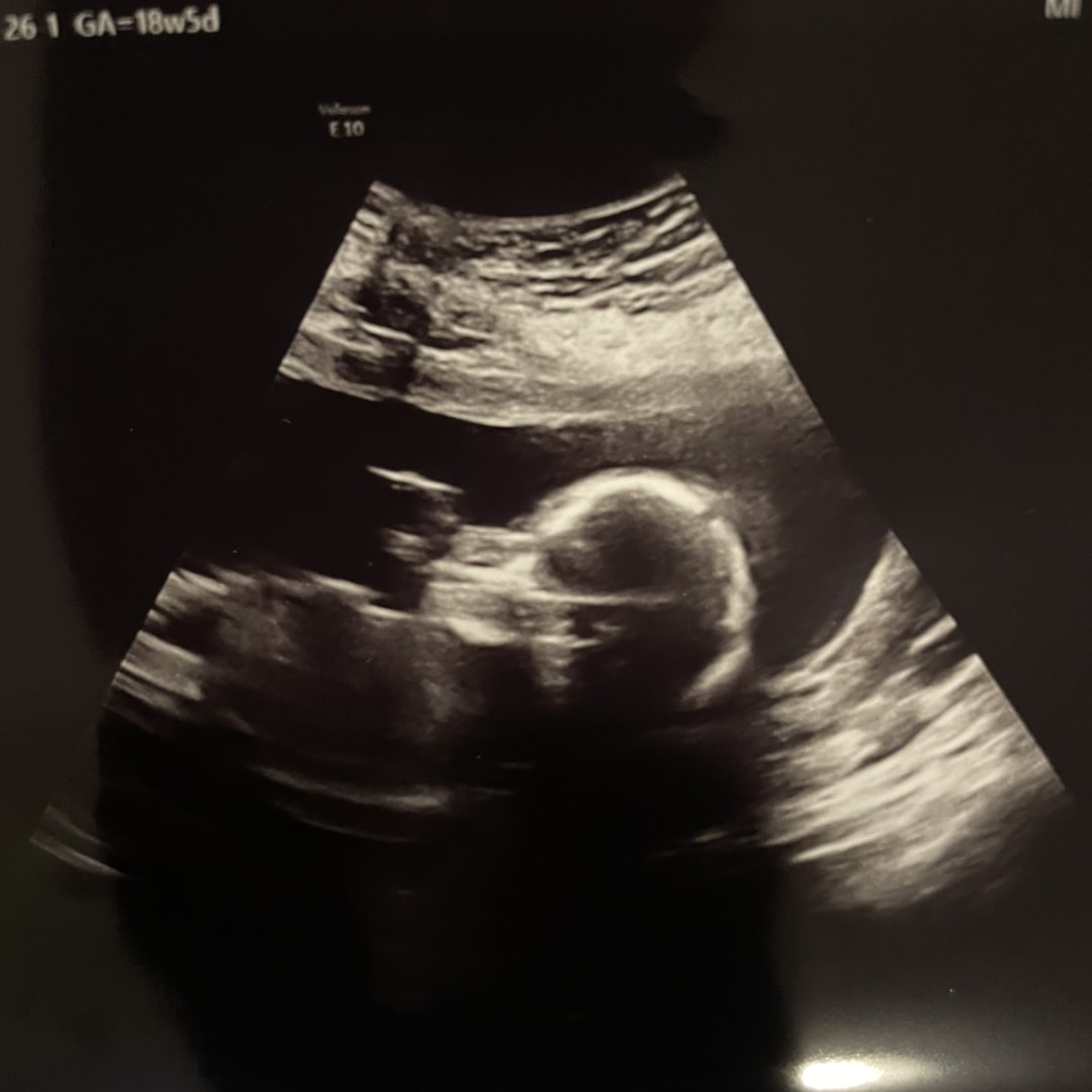 Photo shared by Hilary for their Babylist baby registry.