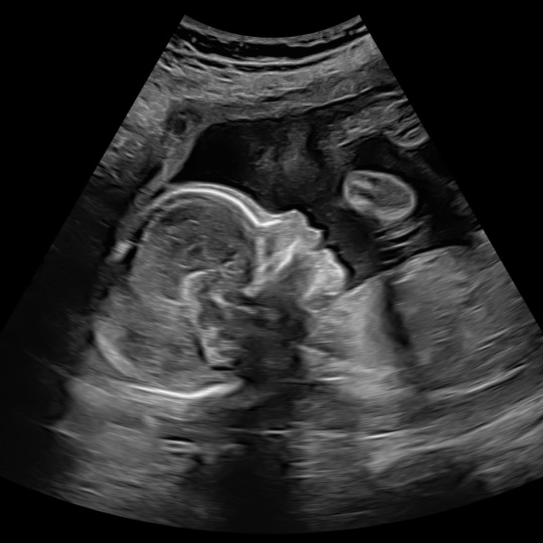 Photo shared by Josh + Bri for their Babylist baby registry.