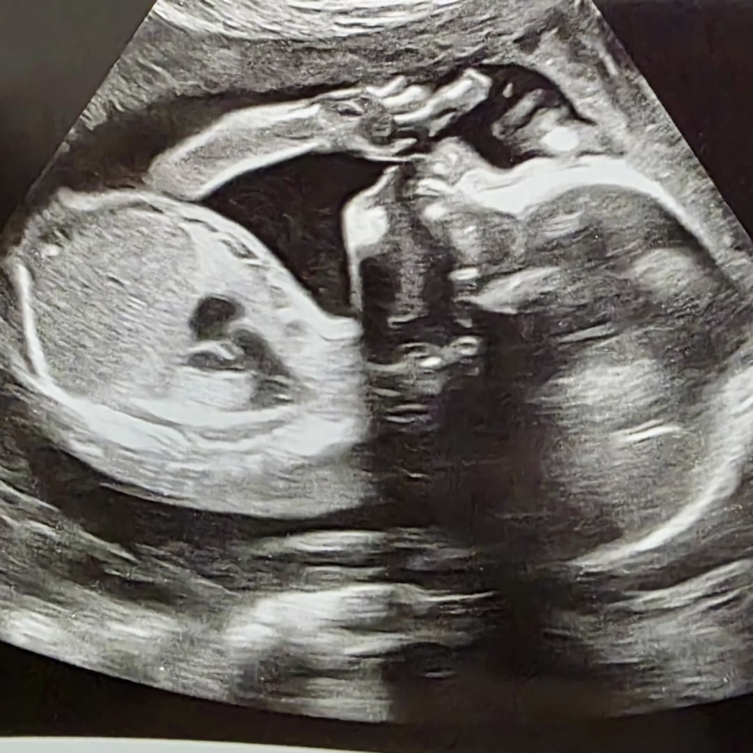 Photo shared by Marcee for their Babylist baby registry.