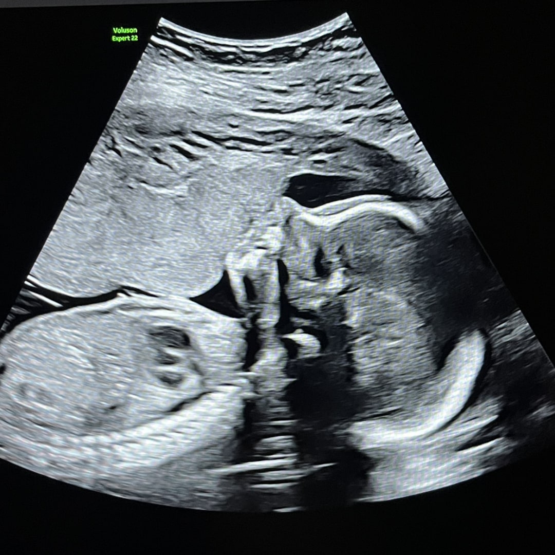 Photo shared by Victoria for their Babylist baby registry.