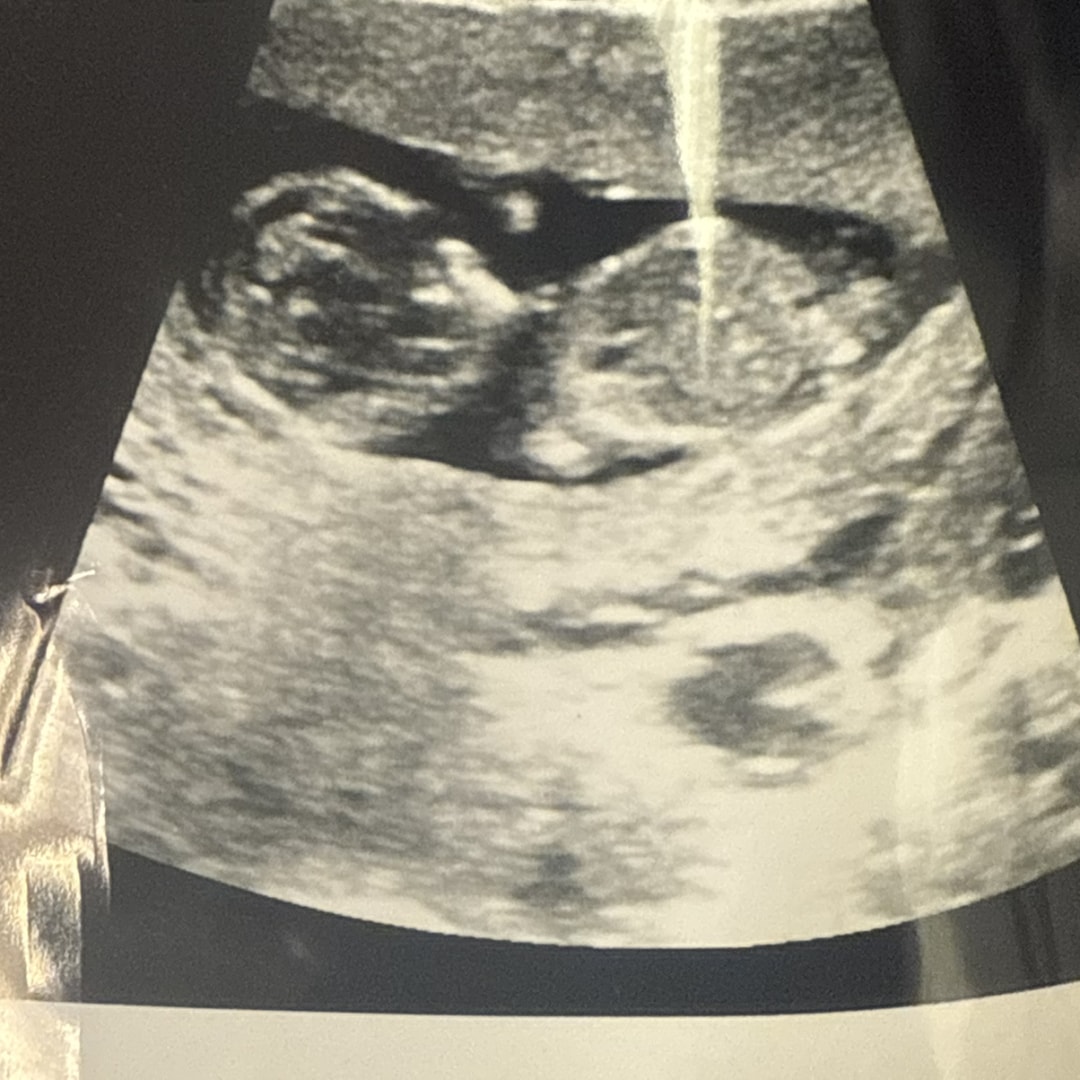 Photo shared by Cassandra for their Babylist baby registry.
