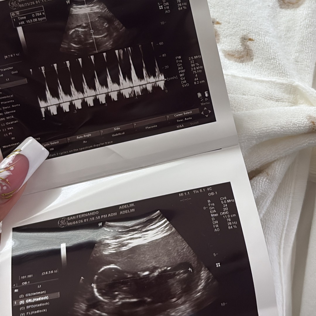 Photo shared by Adelmi for their Babylist baby registry.