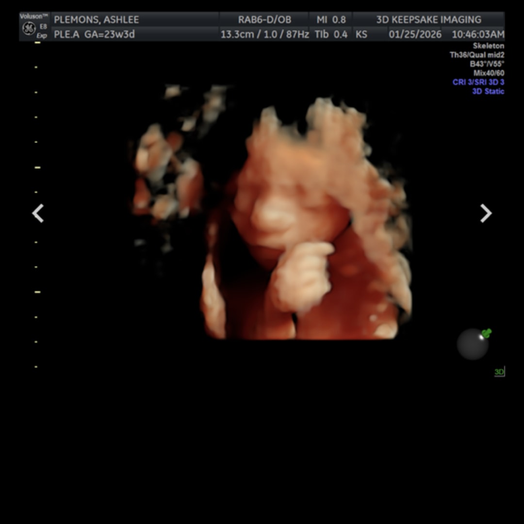 Photo shared by Ashlee for their Babylist baby registry.