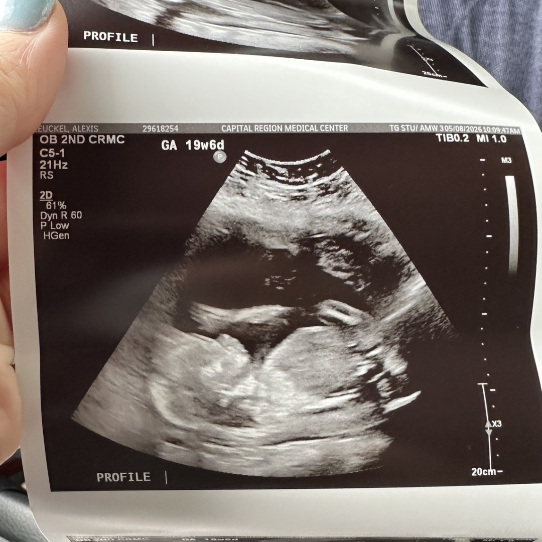Photo shared by Alexis for their Babylist baby registry.