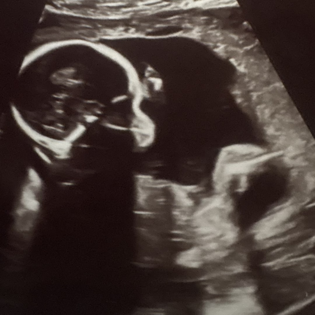 Photo shared by Jack and Kailey for their Babylist baby registry.