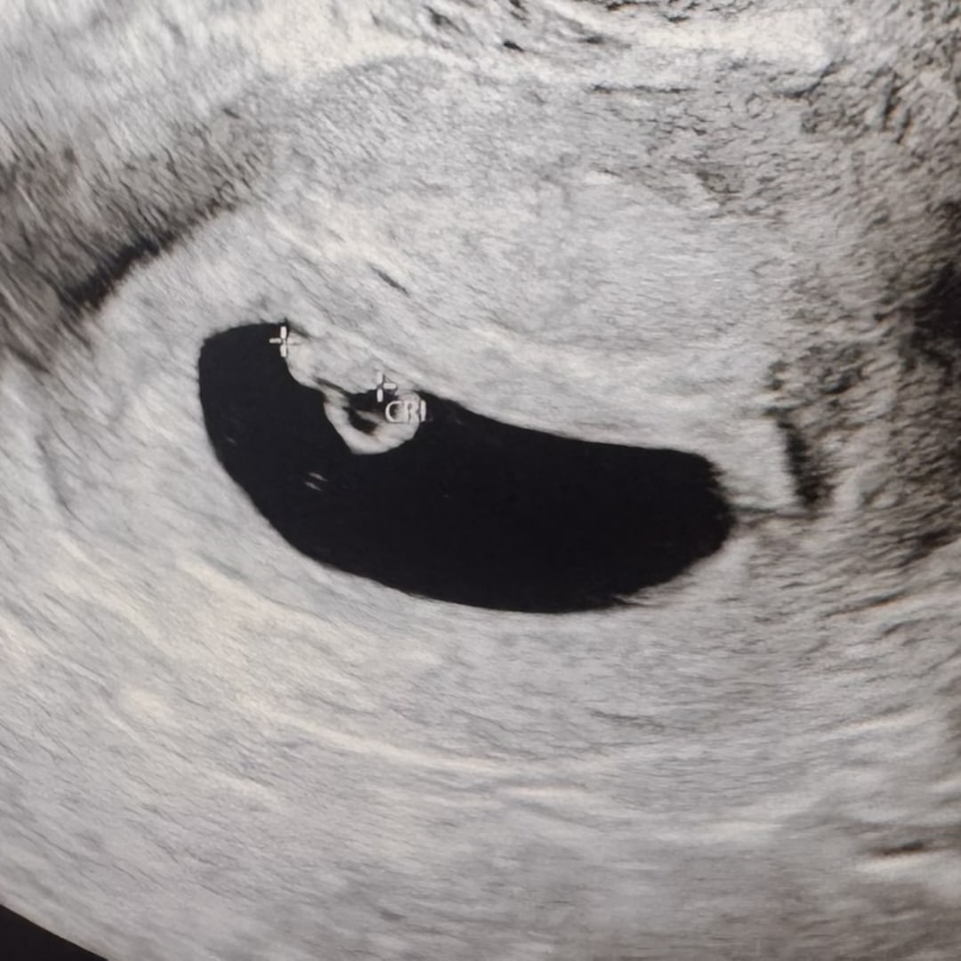 Photo shared by Kayla for their Babylist baby registry.