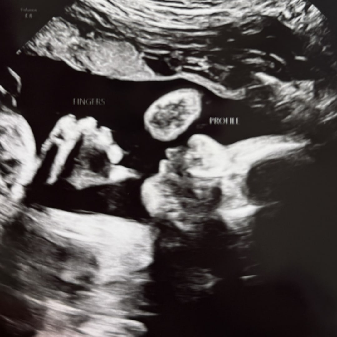Photo shared by Braighlee for their Babylist baby registry.