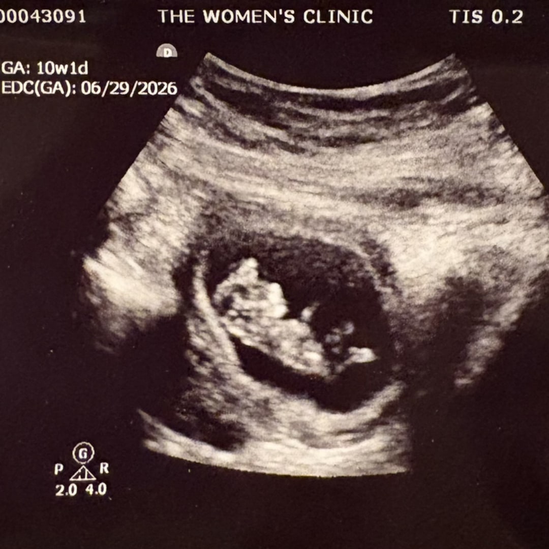 Photo shared by Lexi for their Babylist baby registry.