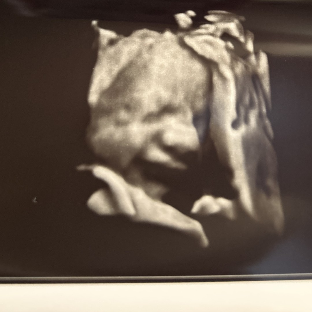 Photo shared by Diana for their Babylist baby registry.