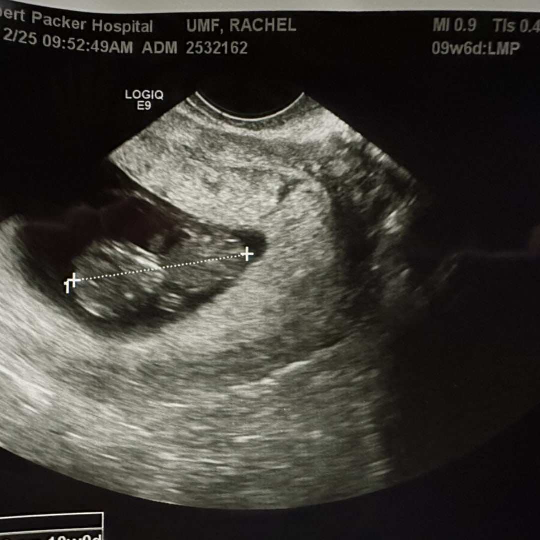 Photo shared by Rachel for their Babylist baby registry.