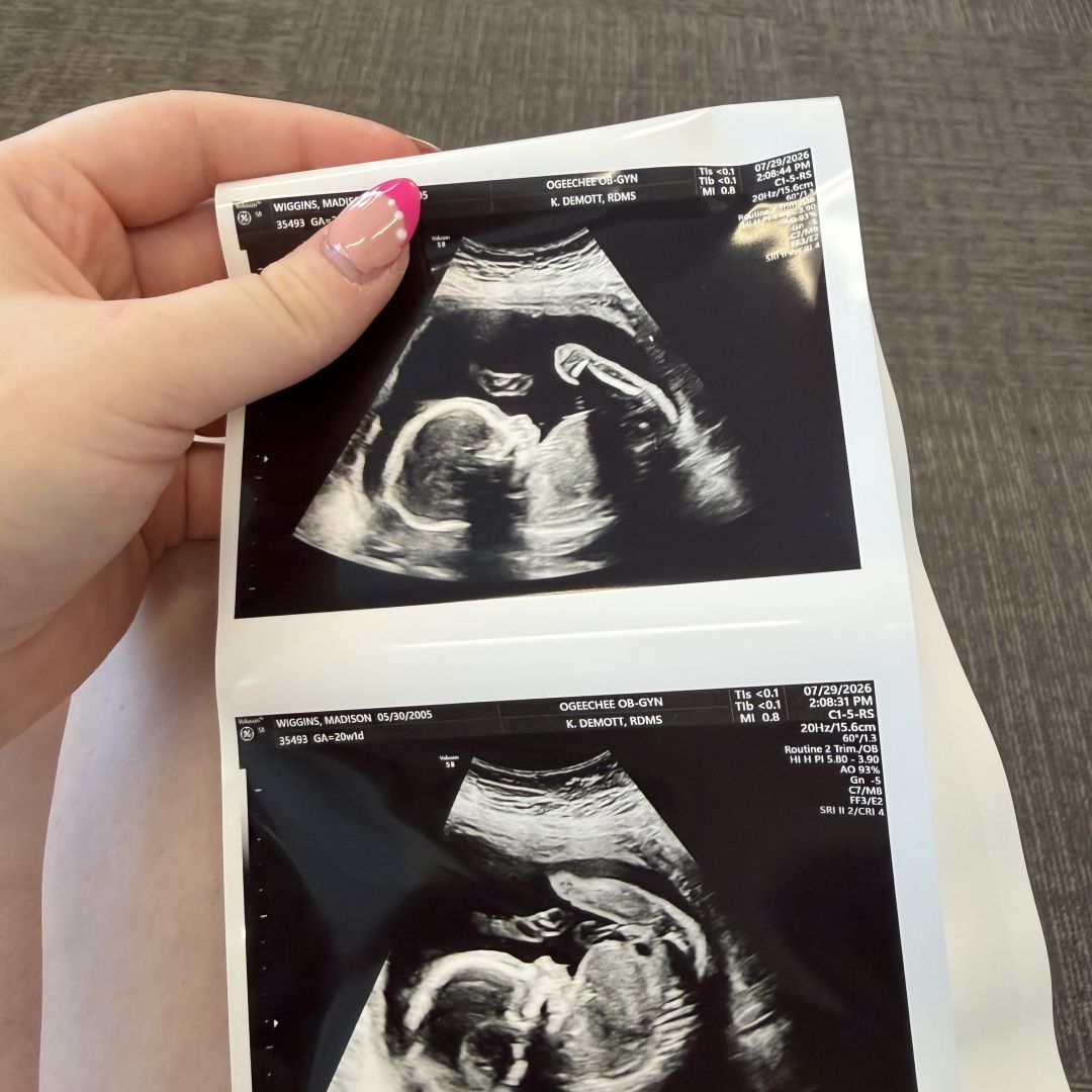 Photo shared by Madi for their Babylist baby registry.
