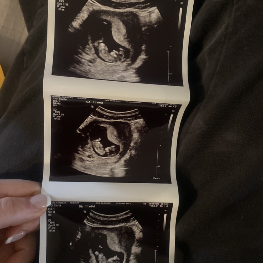 Photo shared by Carissa for their Babylist baby registry.