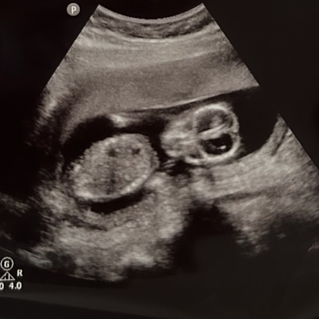 Photo shared by Annie for their Babylist baby registry.