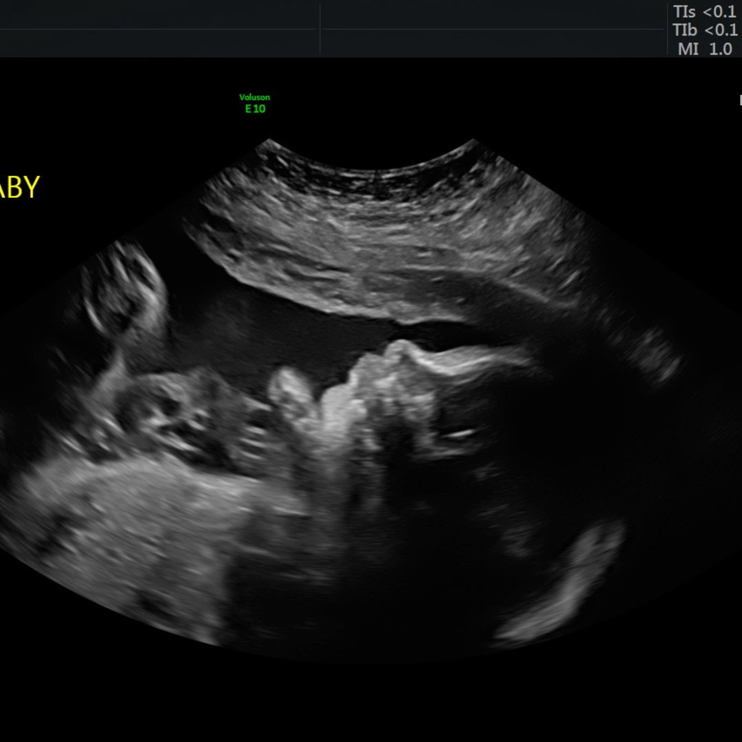 Photo shared by Gretchen for their Babylist baby registry.