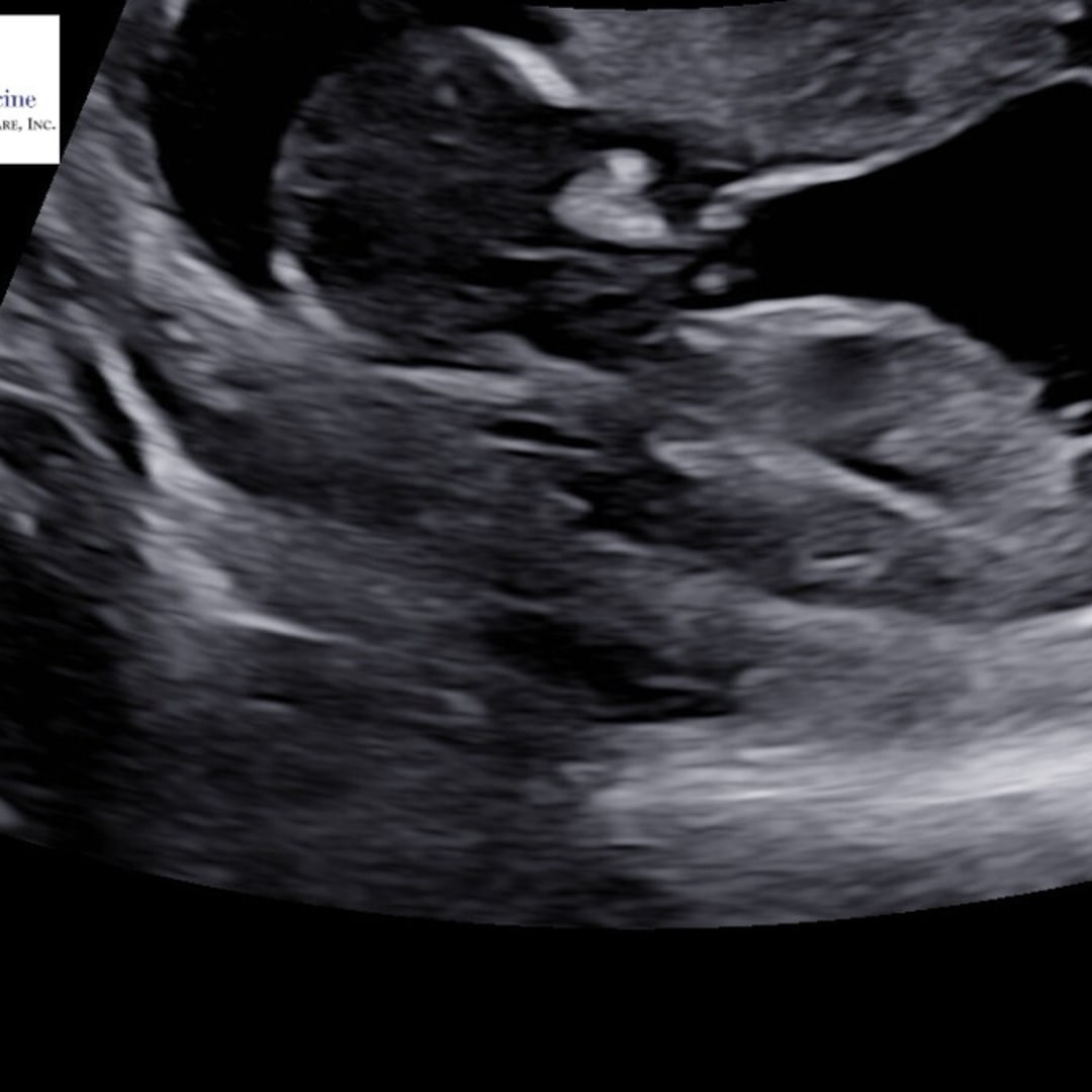 Photo shared by Cadence for their Babylist baby registry.