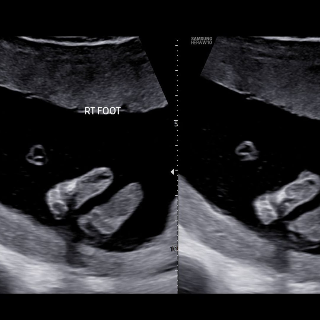 Photo shared by Dorian for their Babylist baby registry.