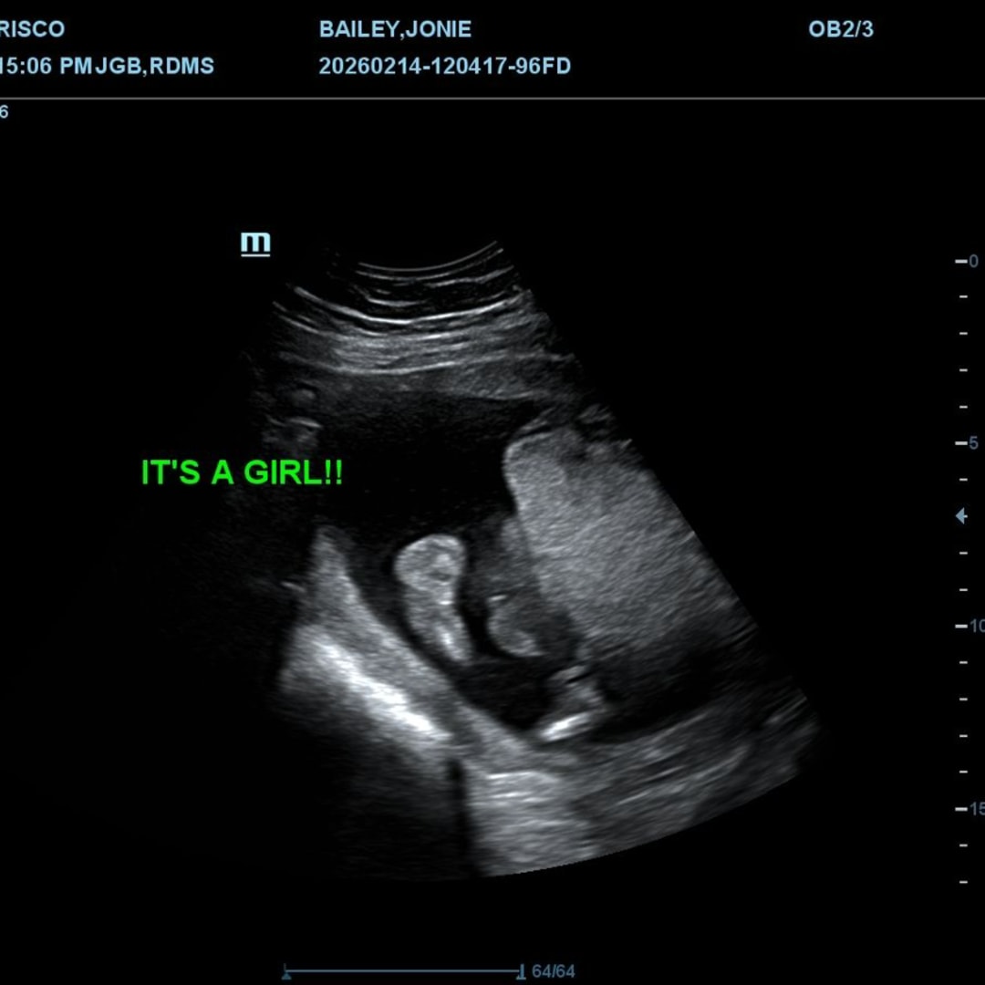 Photo shared by Jonie for their Babylist baby registry.