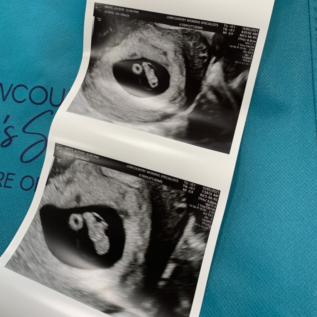 Photo shared by Aly for their Babylist baby registry.