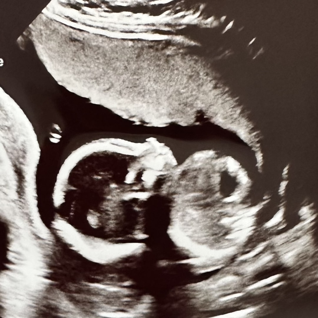 Photo shared by Kinley for their Babylist baby registry.