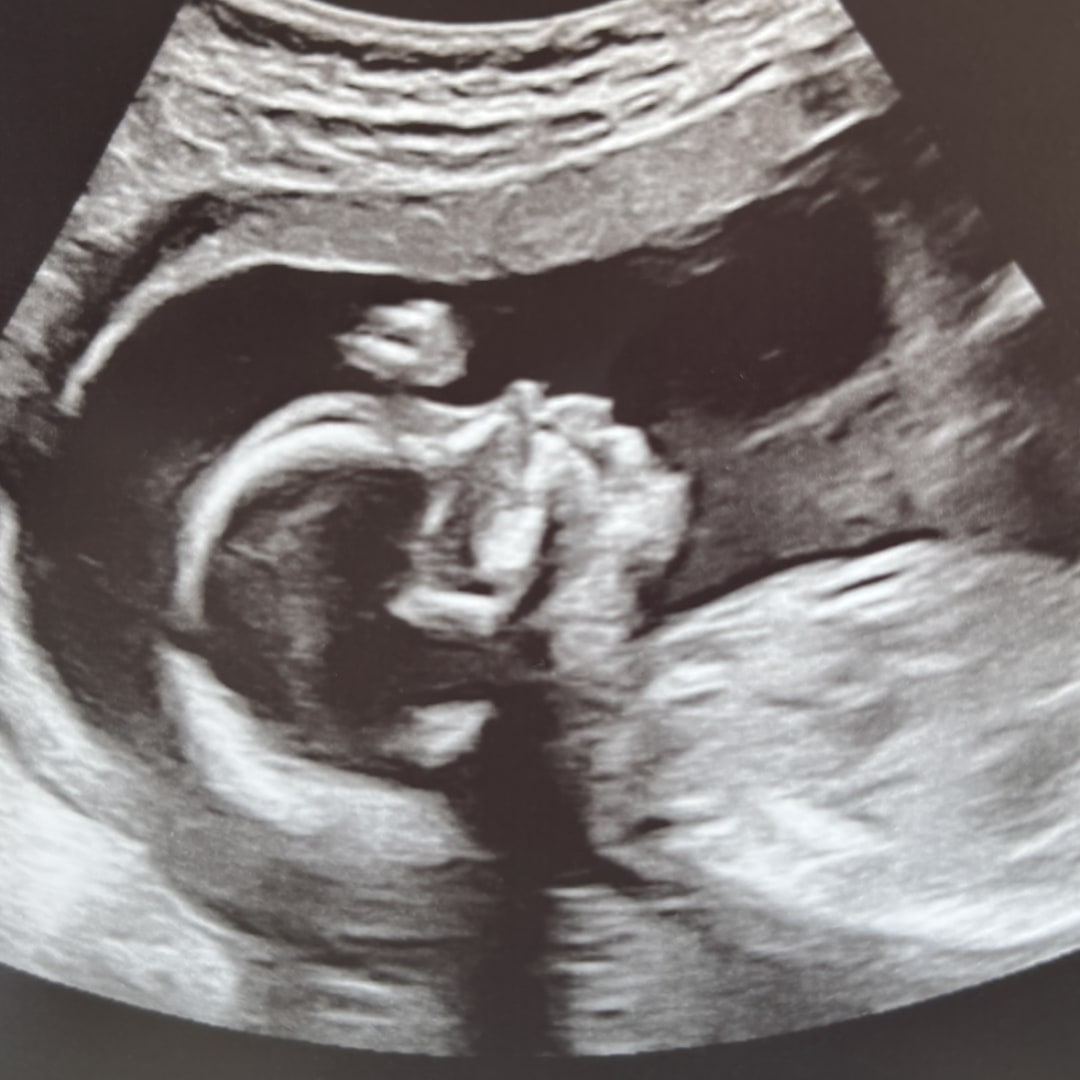 Photo shared by Jake for their Babylist baby registry.