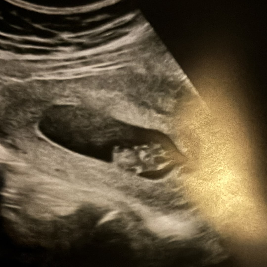 Photo shared by Dana for their Babylist baby registry.