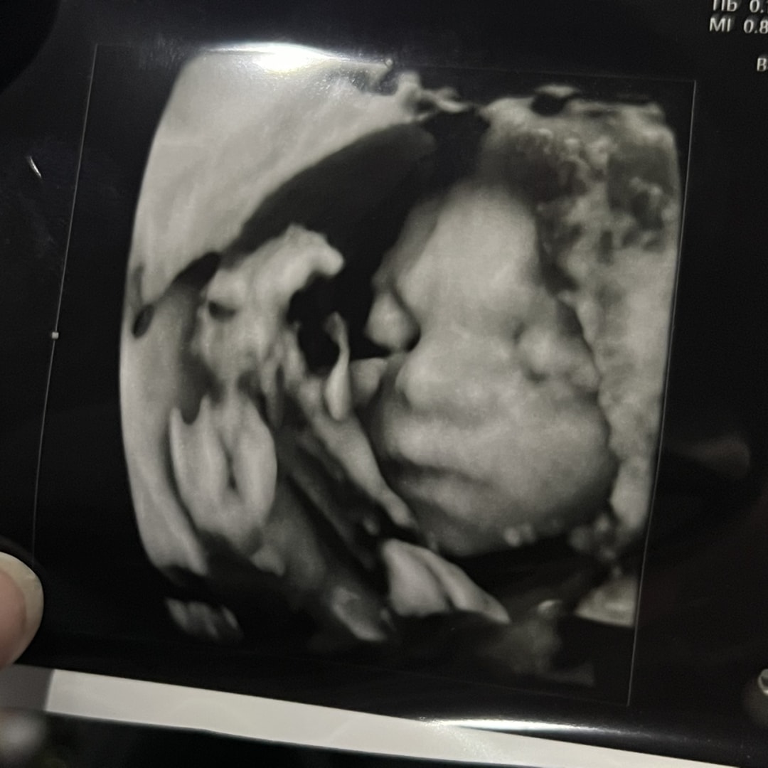 Photo shared by Megan for their Babylist baby registry.