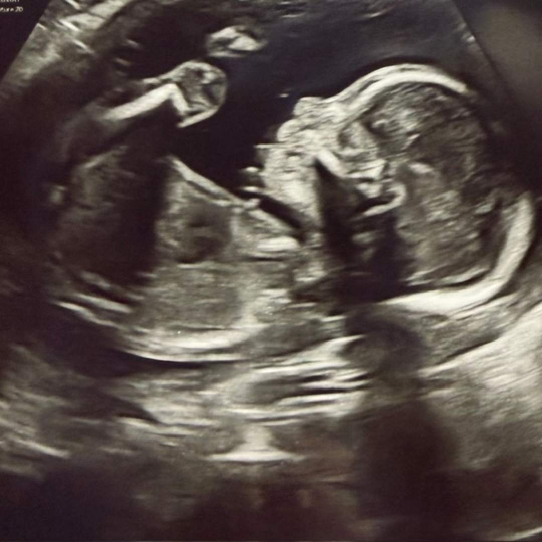 Photo shared by Maddie for their Babylist baby registry.