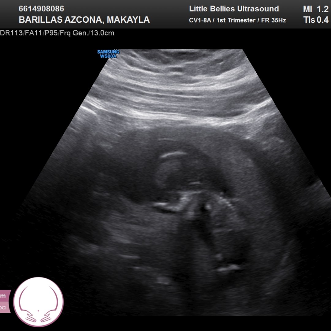 Photo shared by Makayla for their Babylist baby registry.