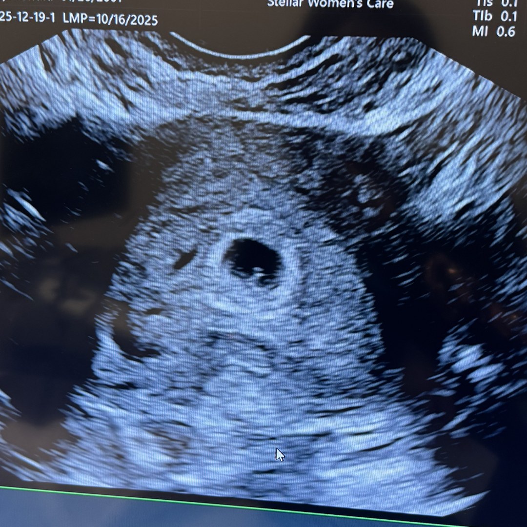 Photo shared by Alondra for their Babylist baby registry.