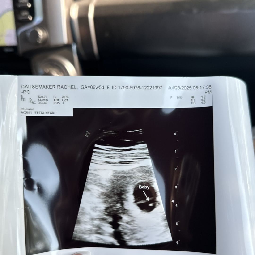 Photo shared by Rachel for their Babylist baby registry.