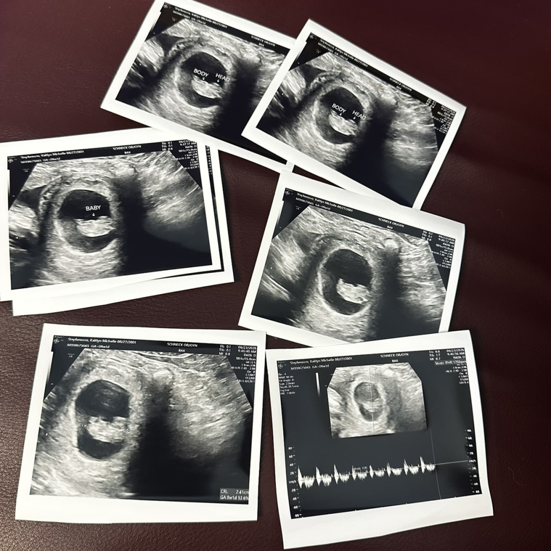 Photo shared by Kaitlyn for their Babylist baby registry.