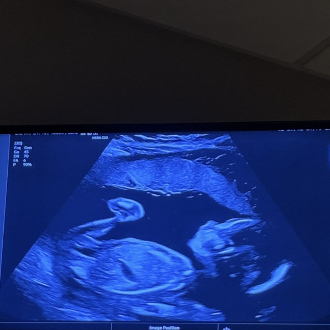 Photo shared by Ava for their Babylist baby registry.