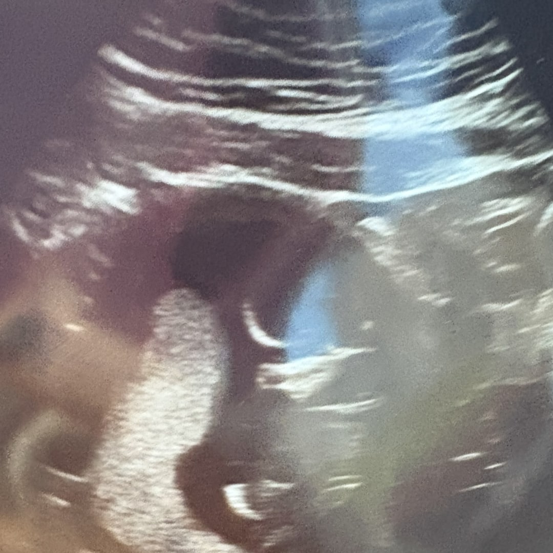 Photo shared by Luci for their Babylist baby registry.