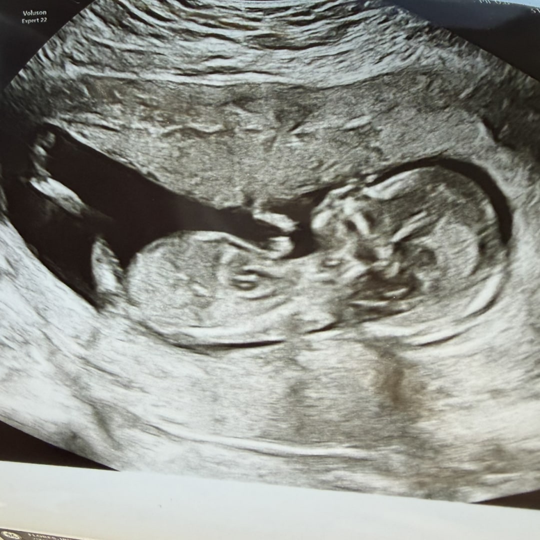 Photo shared by IrisMartha for their Babylist baby registry.